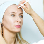 Medical Tourism 2027 | A Discreet Recovery: Why The Week After A Deep Plane Facelift in Istanbul is As important As The Surgery itself | Publisher Luxurylifestylemag